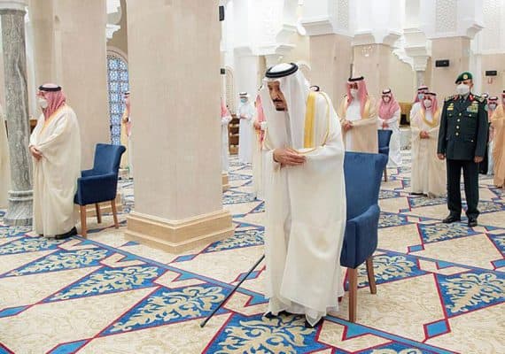 King Salman orders transfer of Yemeni Siamese twins to Riyadh