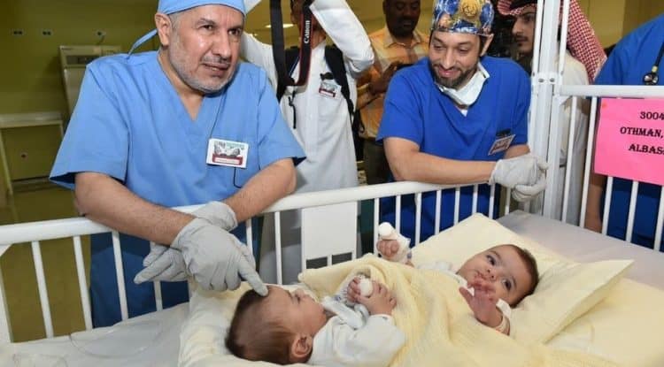 Saudi Arabia tops the world’s countries in the successful separation of conjoined twins