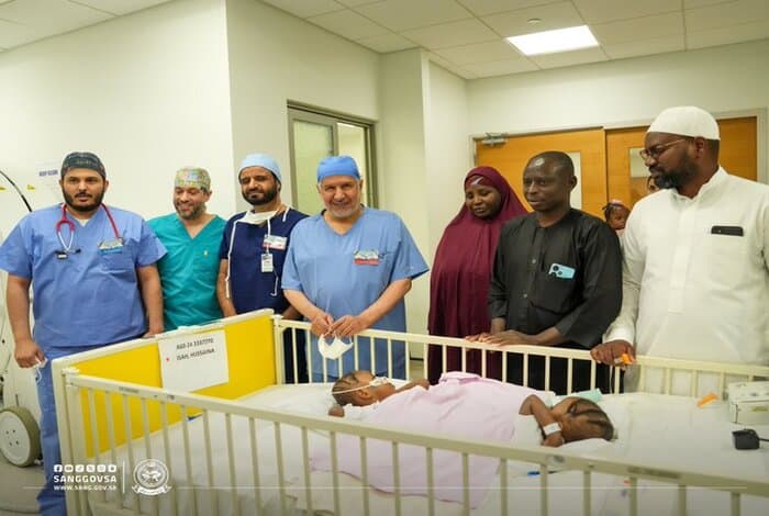 Nigerian Twins Surgery Begins at King Abdullah Children's Hospital