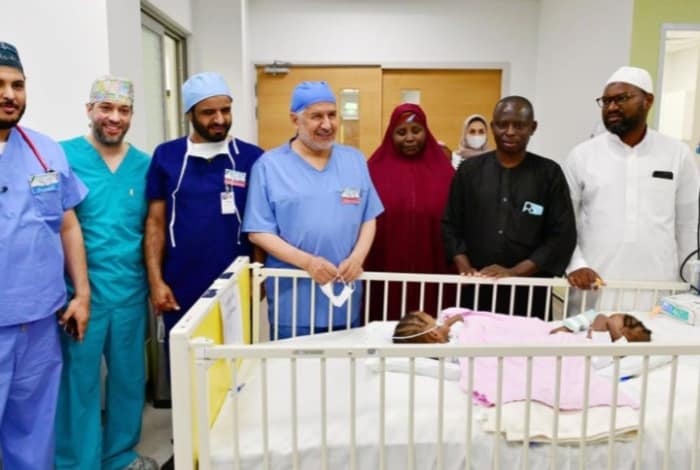 Medical Team Successfully Separates Conjoined Twins Hasna,Husna