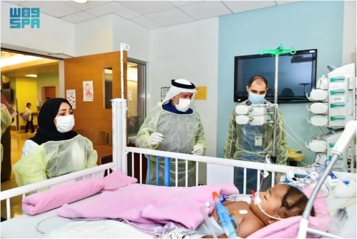 Saudi Medical Team Successfully Separates Nigerian Conjoined Twins