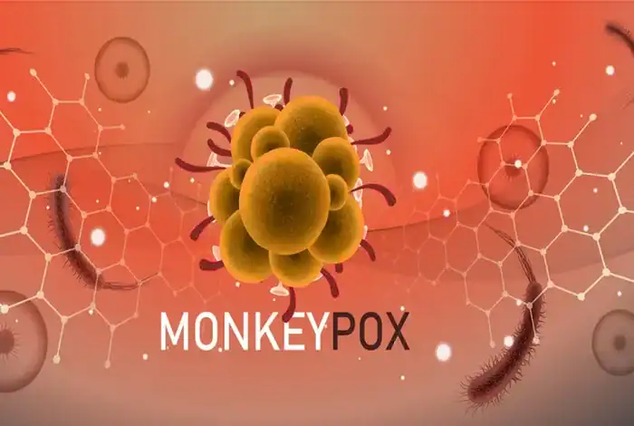 What is Difference Between Monkeypox Corona, Can it Turn into Pandemic?