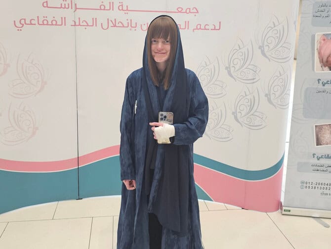 Butterfly Organization: Saudi Arabia’s Message of Hope to Rare Skin Patients