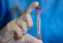 Saudi Public Health Authority Reassures Public Over Hantavirus Threat