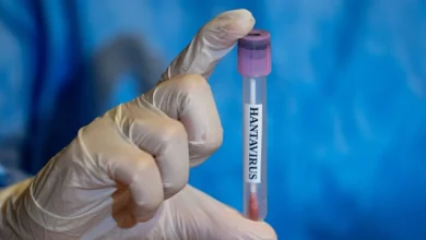 Saudi Public Health Authority Reassures Public Over Hantavirus Threat