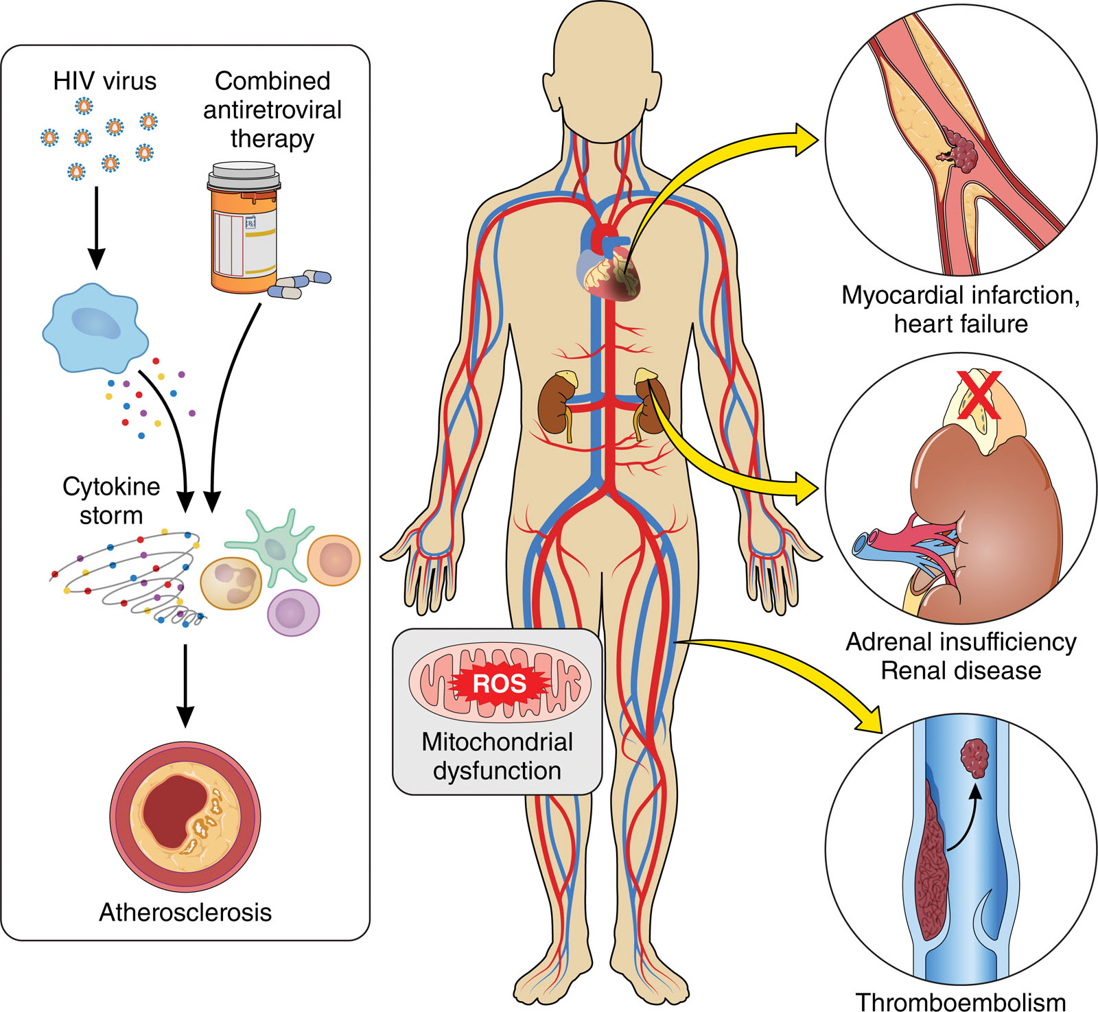 INTERVIEW: Dr. Gehad Elkady on Hidden Cardiovascular Risks Facing HIV Patients