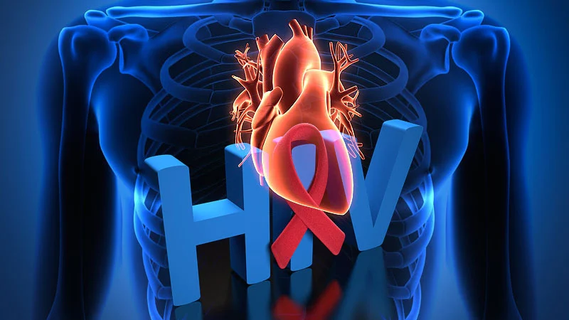 a visual summary of how HIV infection—and in some cases its treatment—can contribute to cardiovascular and other systemic diseases.